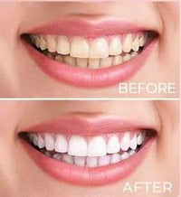 STAR DUST PINK COSMIC SMILE TEETH WHITENING WIRELESS KIT - Happily Ever Atchison Shop Co.